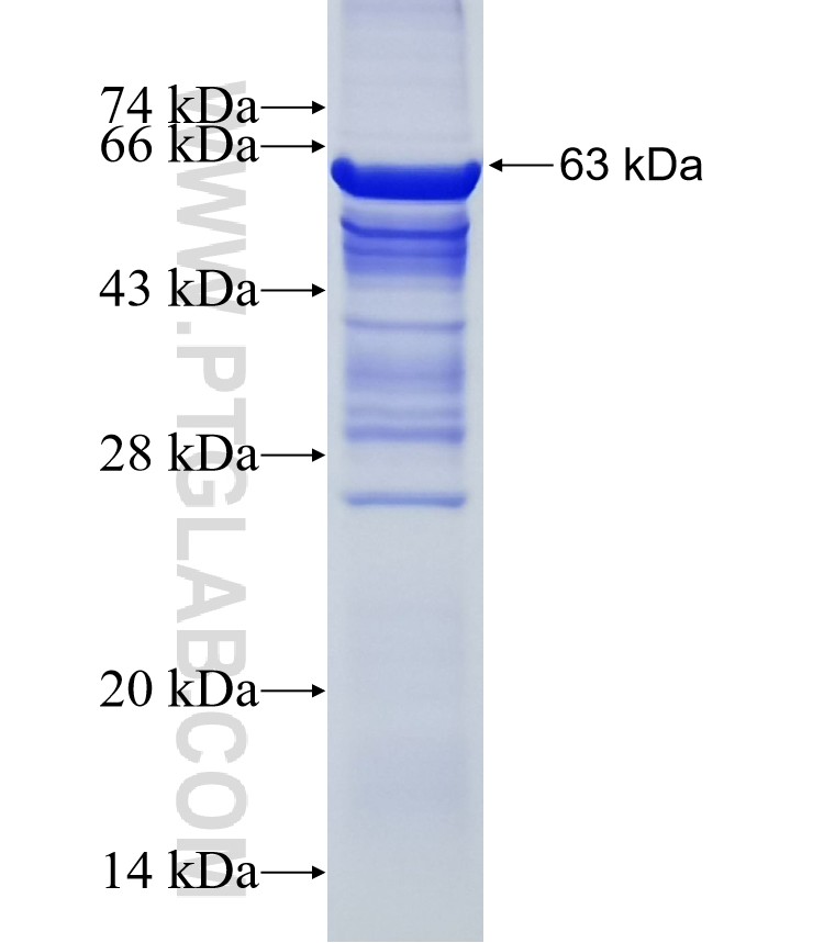 PKP4 fusion protein Ag5113 SDS-PAGE