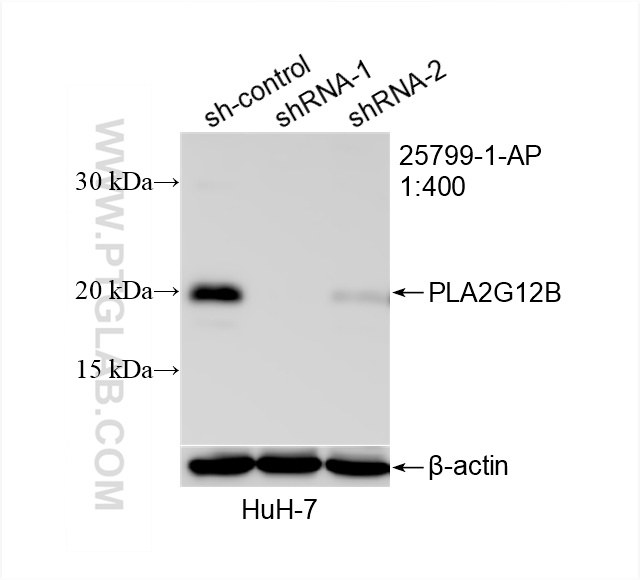 WB analysis of HuH-7 using 25799-1-AP (same clone as 25799-1-PBS)