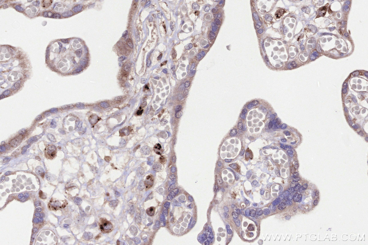 IHC staining of human placenta using 10863-2-AP IHC staining of human placenta using 10863-2-AP