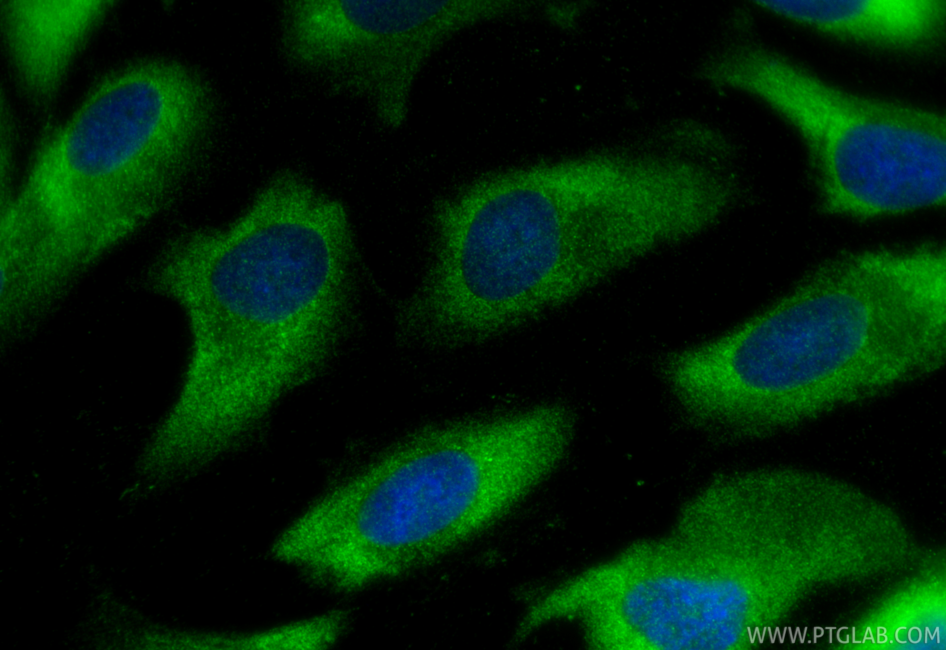 IF Staining of ARPE-19 using 17646-1-AP (same clone as 17646-1-PBS) IF Staining of ARPE-19 using 17646-1-AP (same clone as 17646-1-PBS)