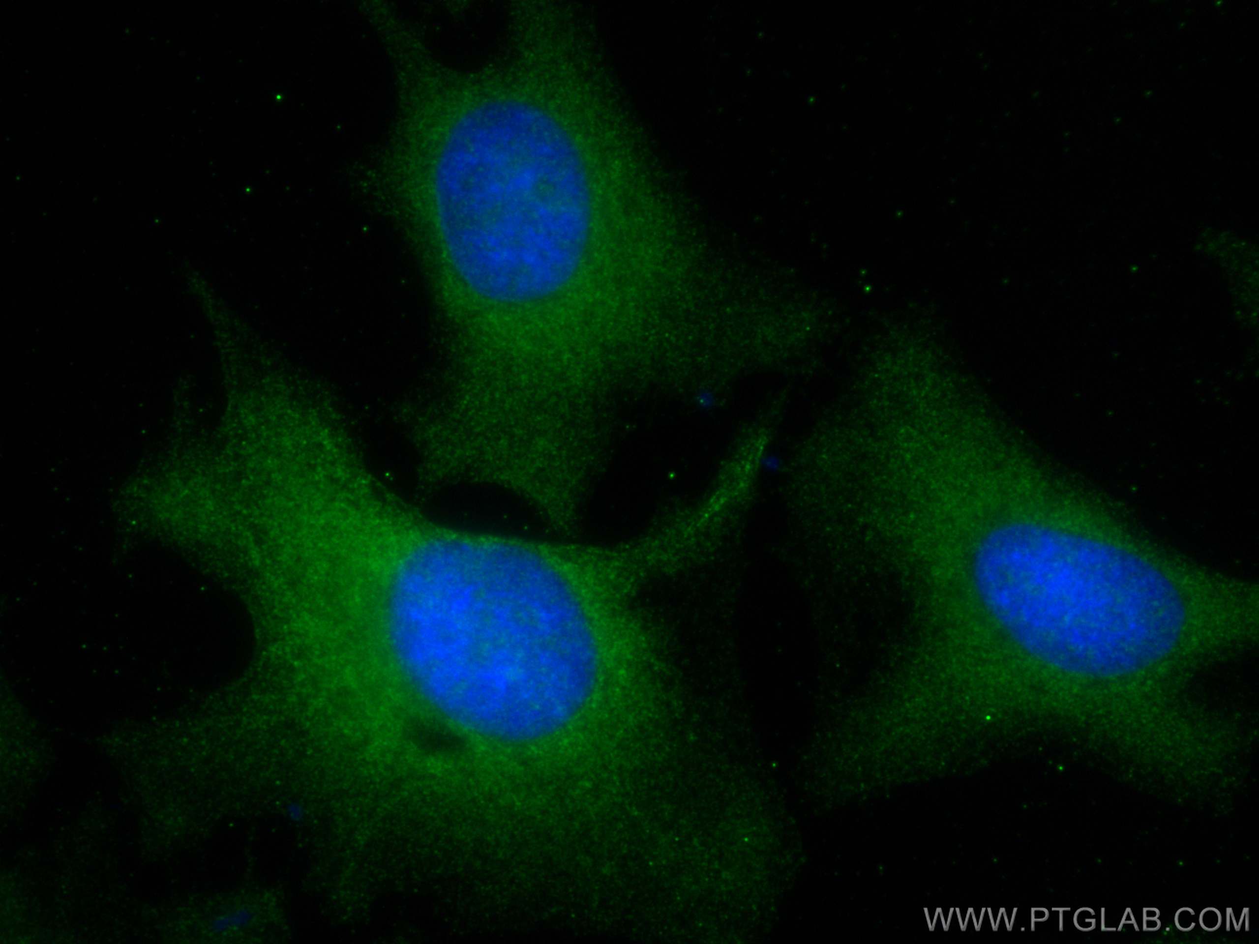 IF Staining of HeLa using 68133-1-Ig