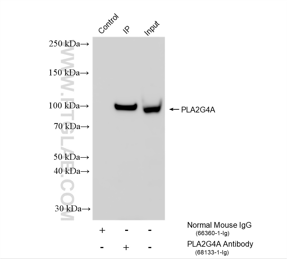 IP experiment of HeLa using 68133-1-Ig IP experiment of HeLa using 68133-1-Ig