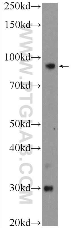 WB analysis of human plasma using 55074-1-AP