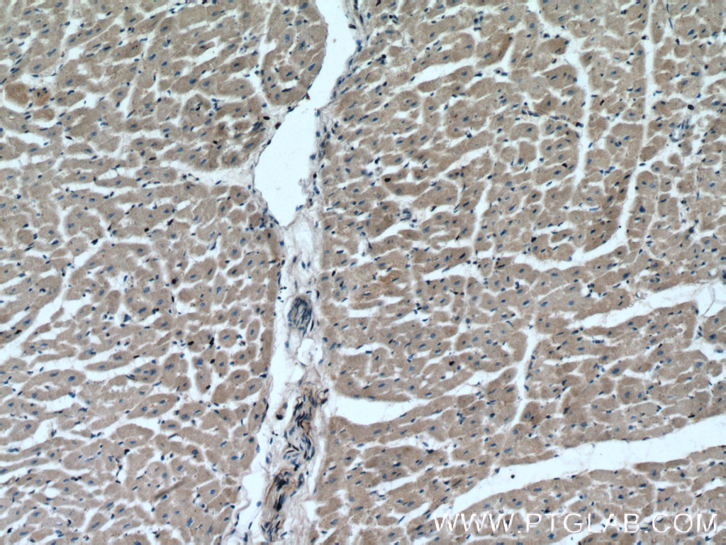 IHC staining of human heart using 14904-1-AP