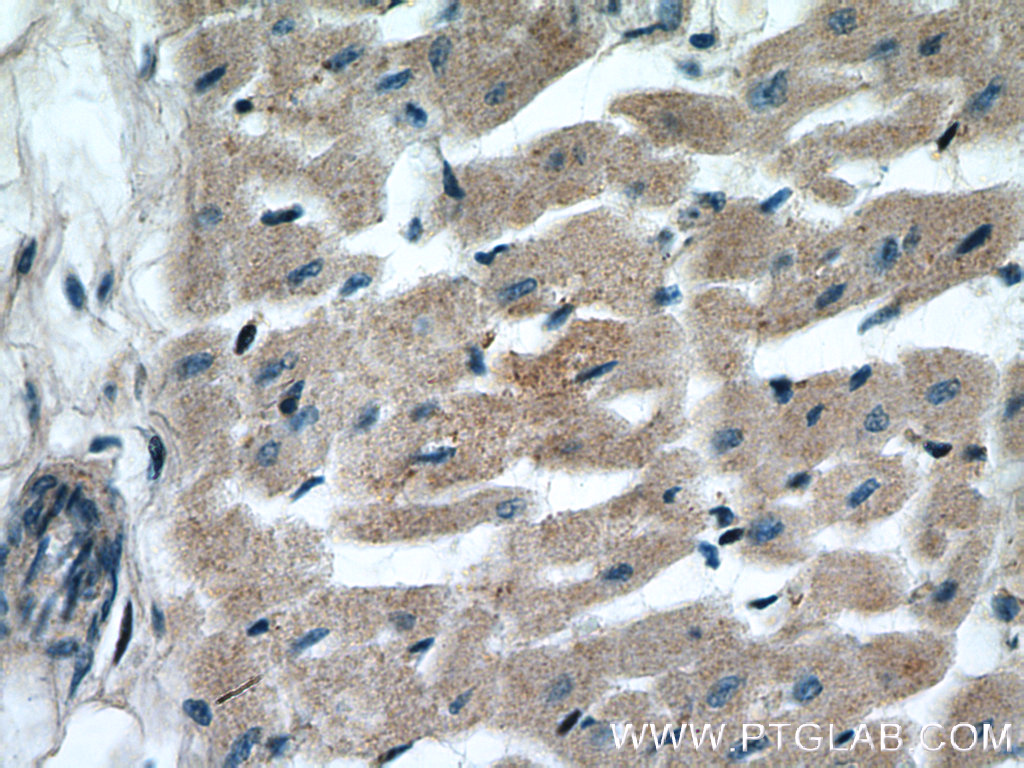 IHC staining of human heart using 14904-1-AP