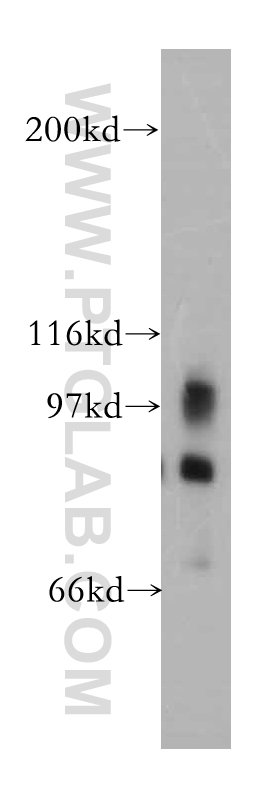 WB analysis of mouse brain using 13345-1-AP