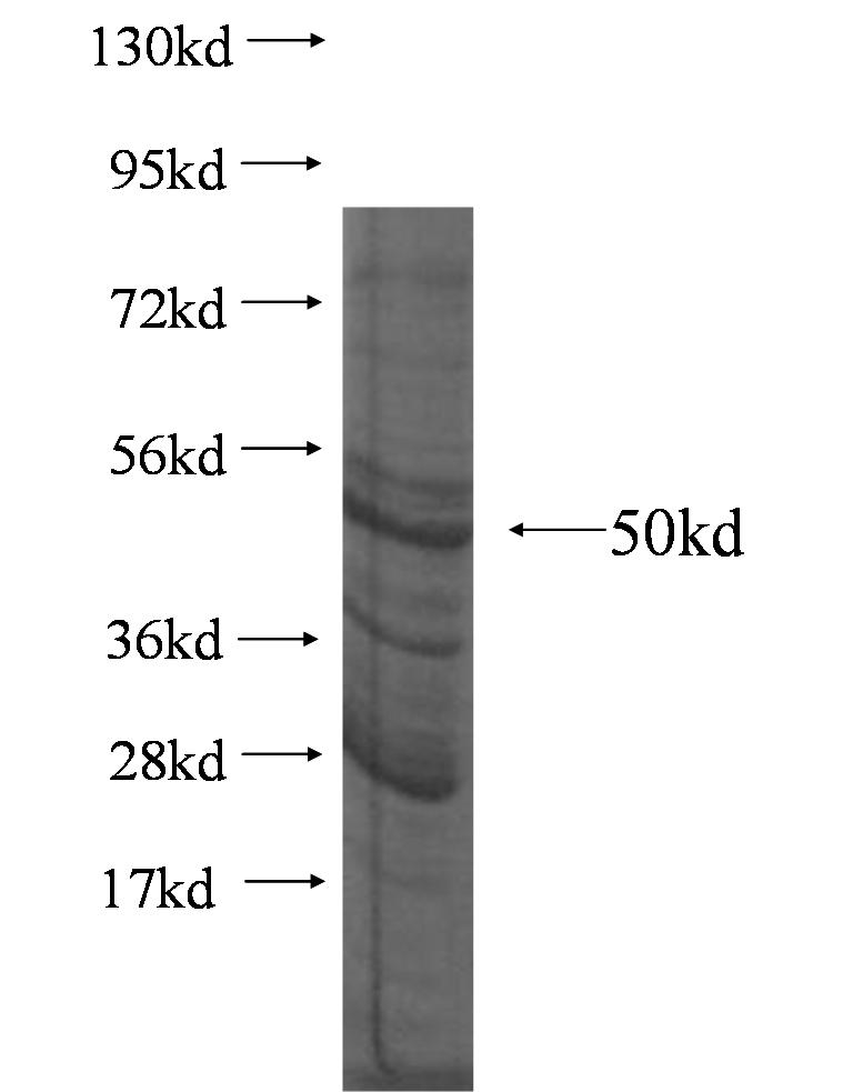 PLA2G4D fusion protein Ag4178 SDS-PAGE