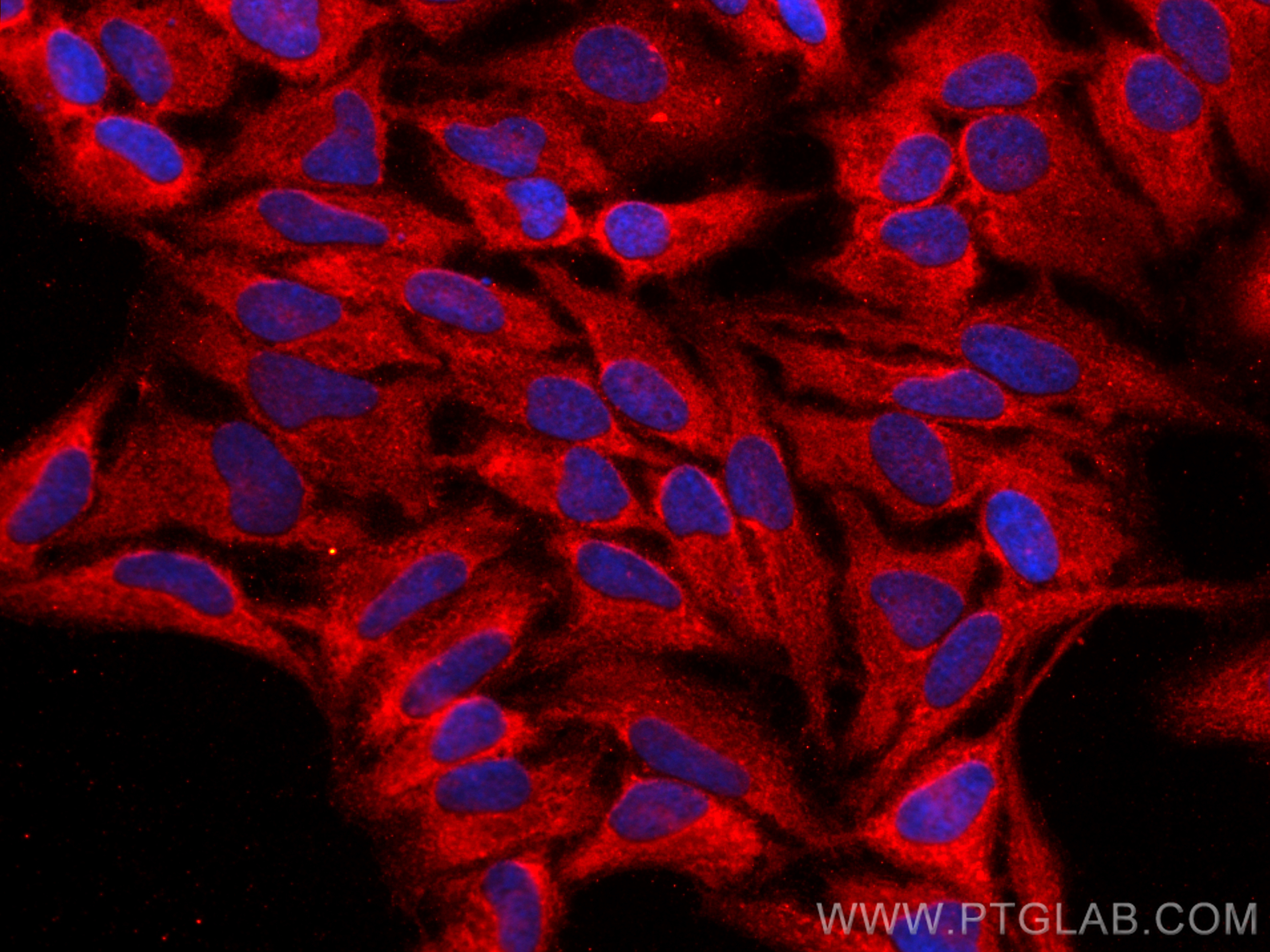 IF Staining of HeLa using 18088-1-AP (same clone as 18088-1-PBS)