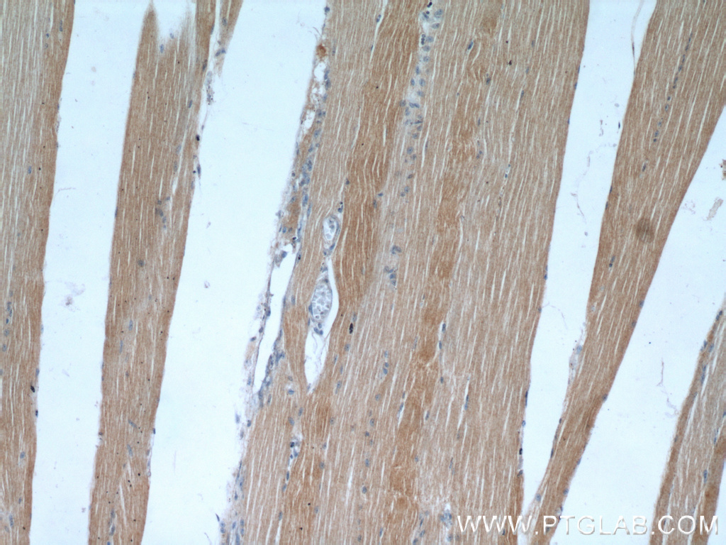 IHC staining of human skeletal muscle using 18088-1-AP (same clone as 18088-1-PBS)