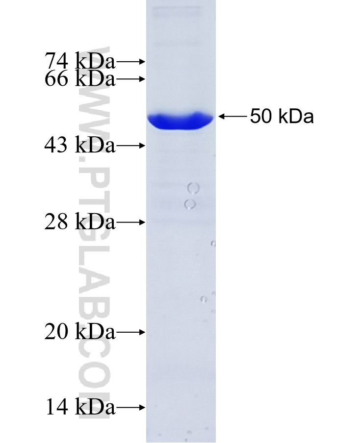 PLA2G4E fusion protein Ag12548 SDS-PAGE