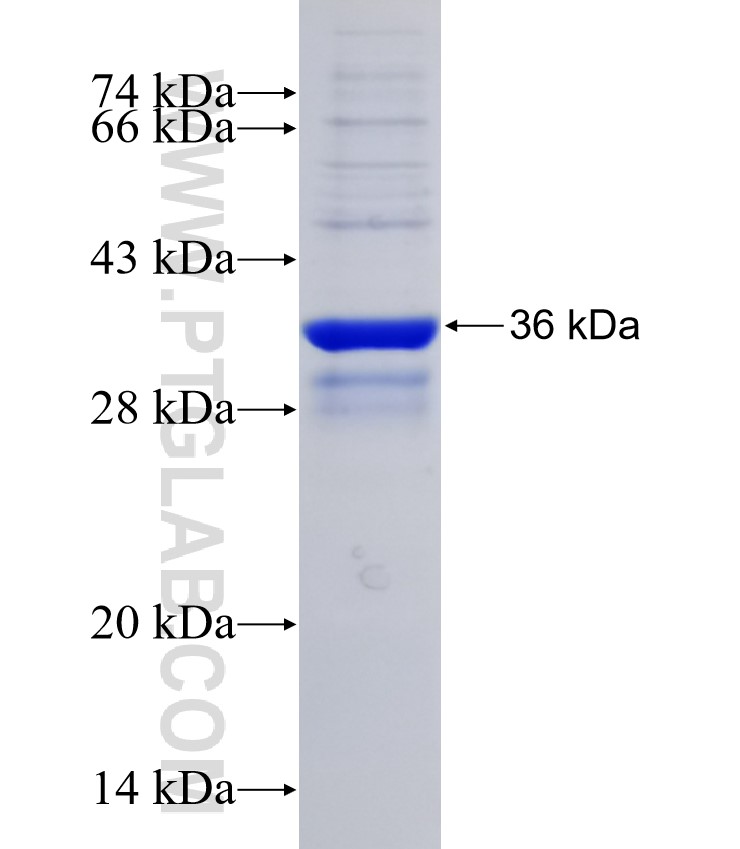 PLA2G5 fusion protein Ag29302 SDS-PAGE