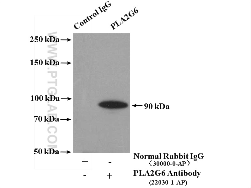 IP experiment of mouse testis using 22030-1-AP