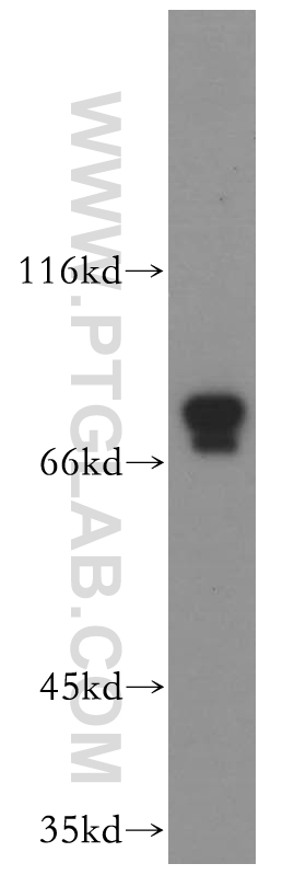 WB analysis of K-562 using 12529-1-AP (same clone as 12529-1-PBS)