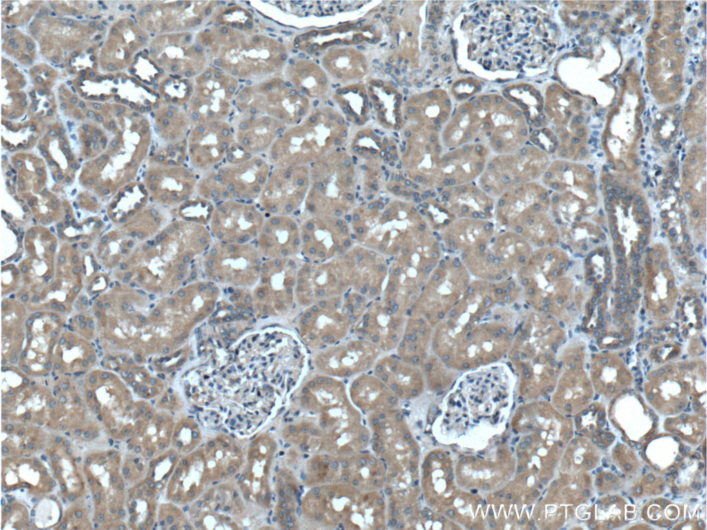 IHC staining of human kidney using 60244-1-Ig (same clone as 60244-1-PBS)