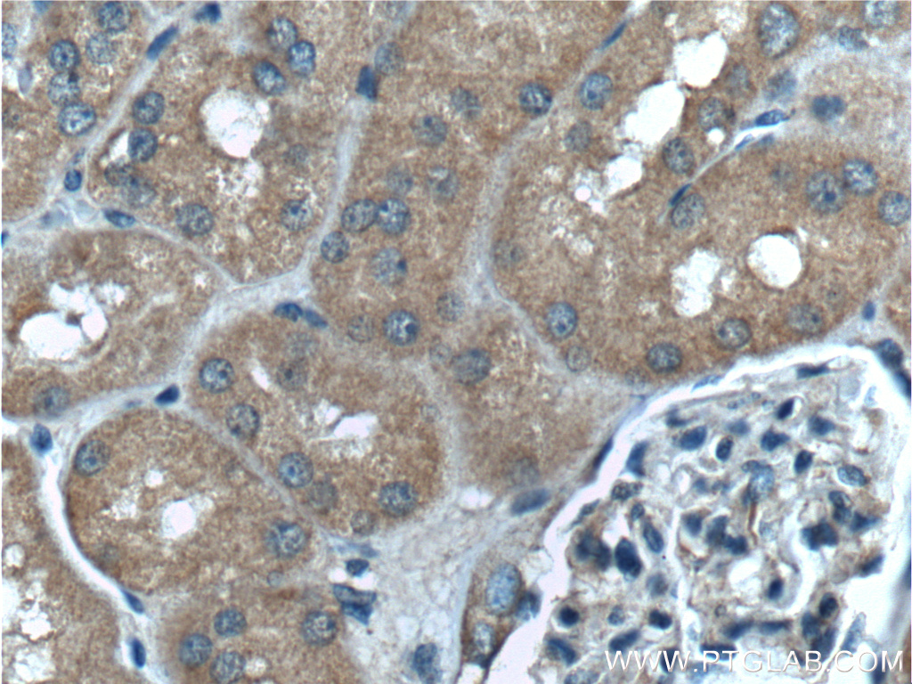 IHC staining of human kidney using 60244-1-Ig (same clone as 60244-1-PBS)
