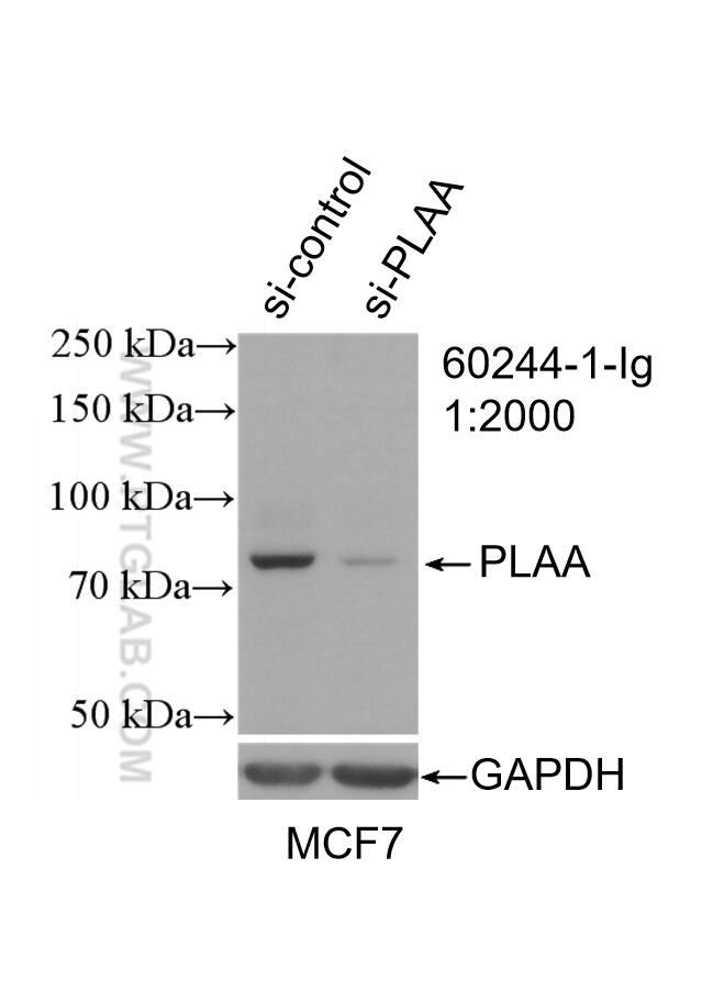 WB analysis of MCF-7 using 60244-1-Ig (same clone as 60244-1-PBS)