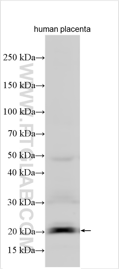 WB analysis using 55209-1-AP