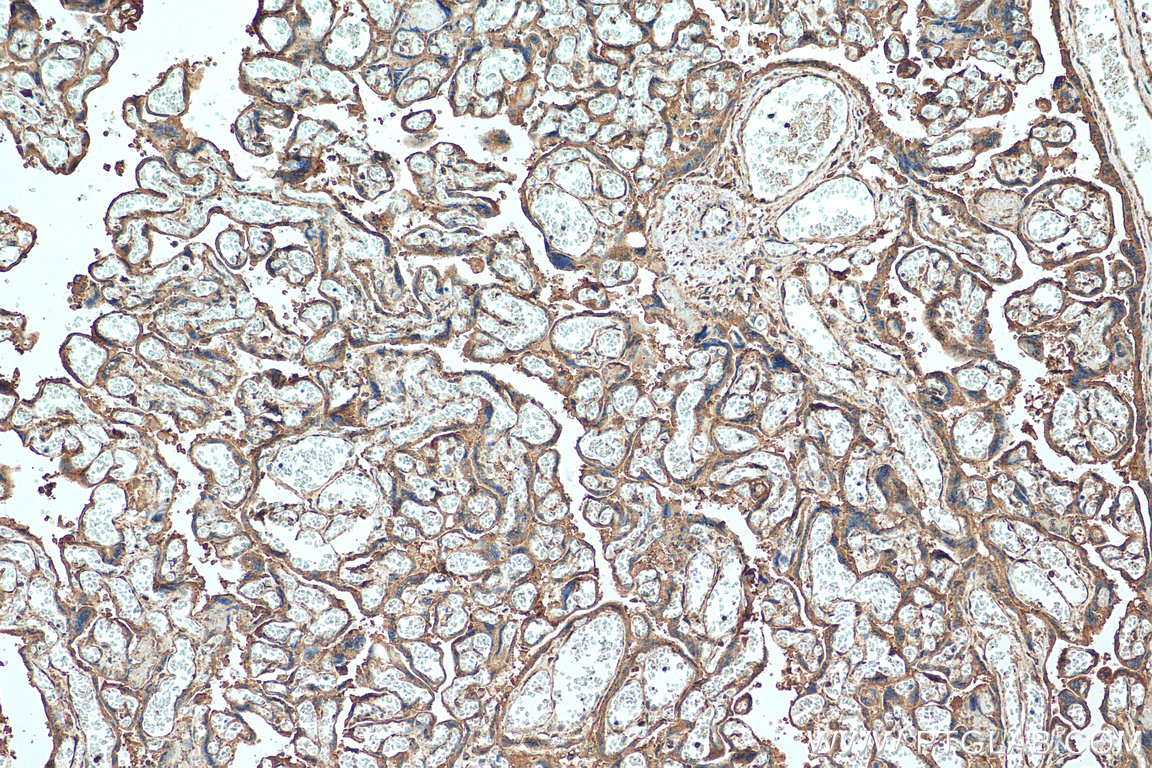 IHC staining of human placenta using 26838-1-AP