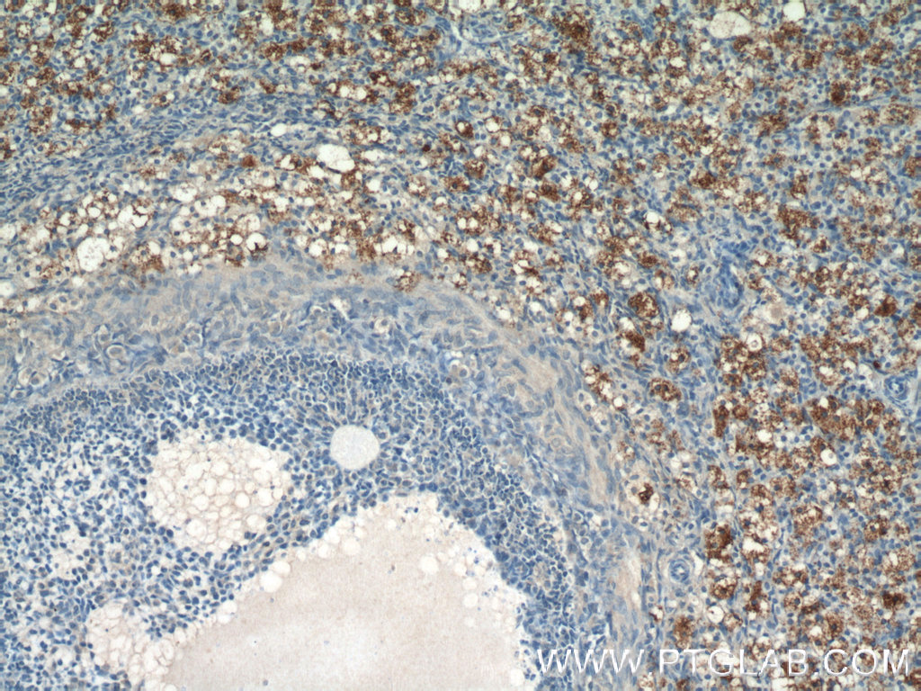 IHC staining of human ovary using 17343-1-AP
