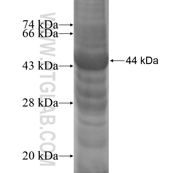 PLAC1L fusion protein Ag11384 SDS-PAGE