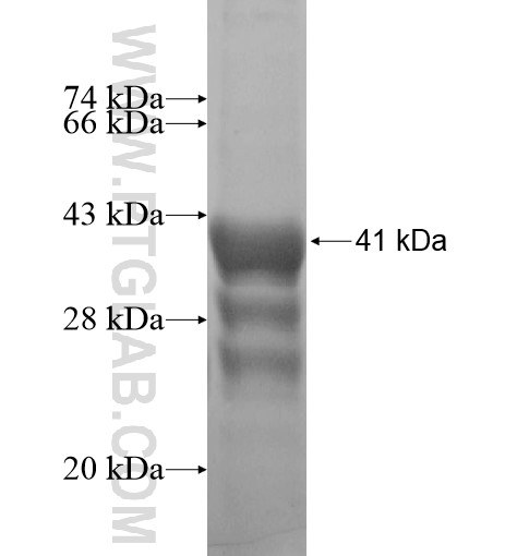 PLAC4 fusion protein Ag12809 SDS-PAGE PLAC4 fusion protein Ag12809 SDS-PAGE