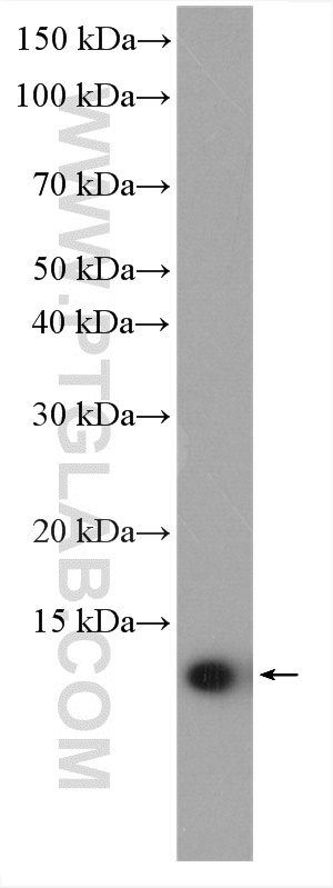 WB analysis of human peripheral blood leukocyte using 12284-1-AP