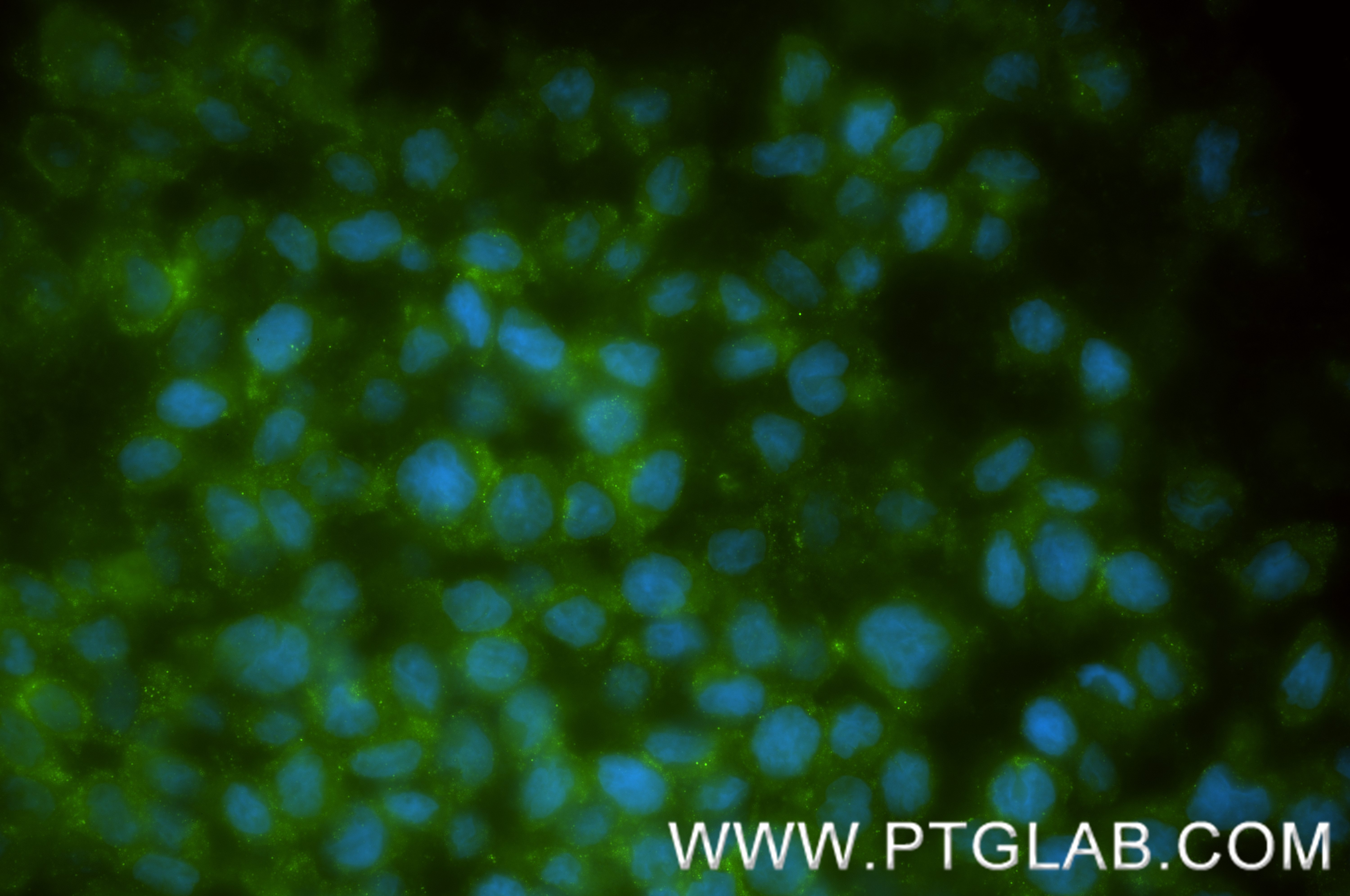 IF Staining of THP-1 using 87918-1-RR IF Staining of THP-1 using 87918-1-RR