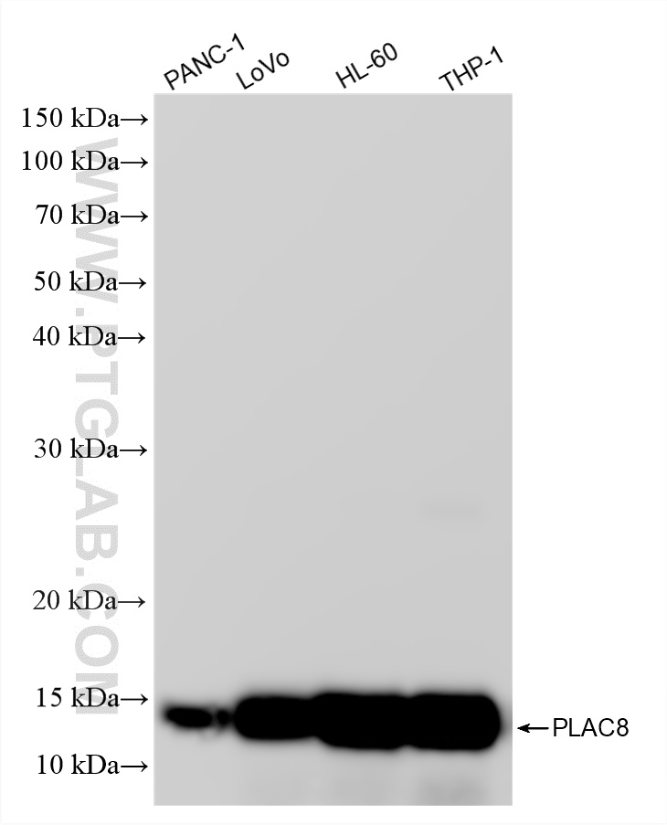 WB analysis using 87918-1-RR WB analysis using 87918-1-RR