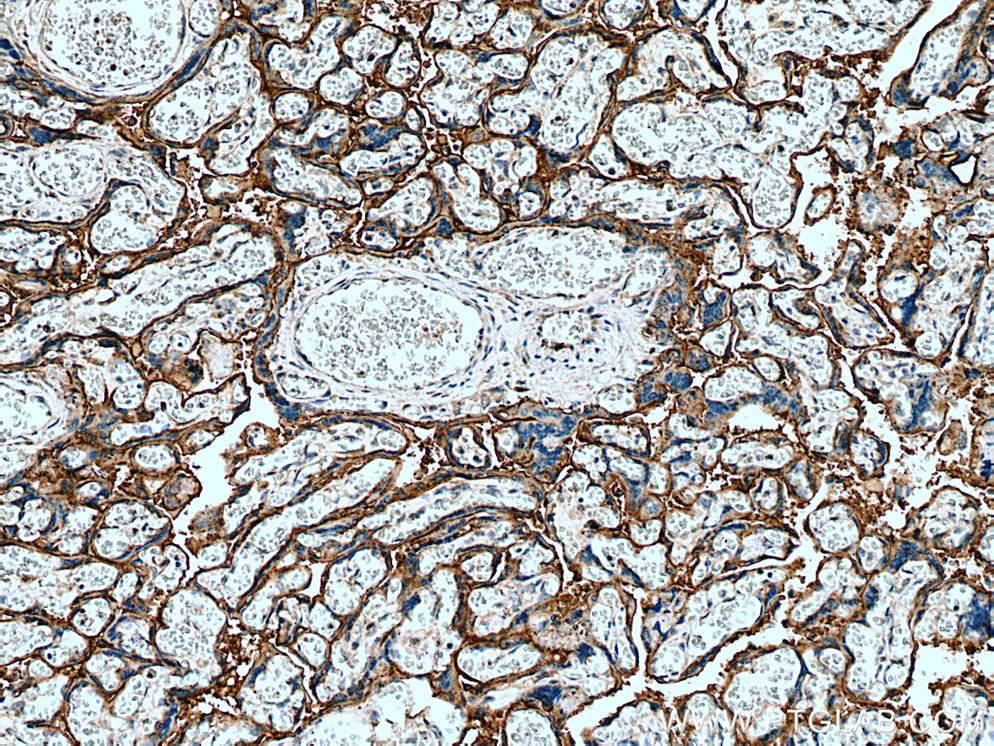 IHC staining of human placenta using 25435-1-AP