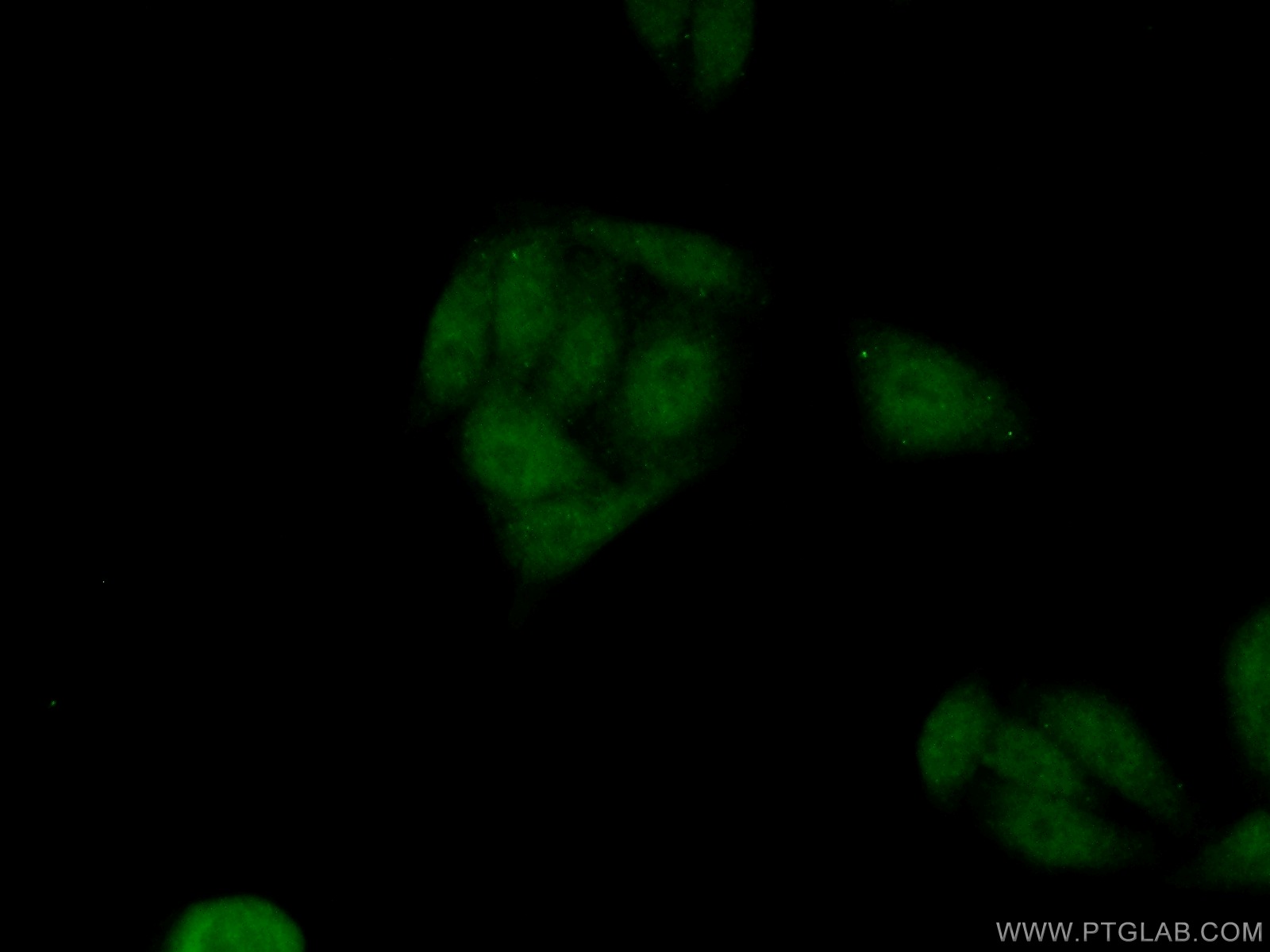 IF Staining of HepG2 using 18018-1-AP