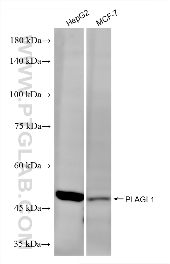 WB analysis using 87281-1-RR