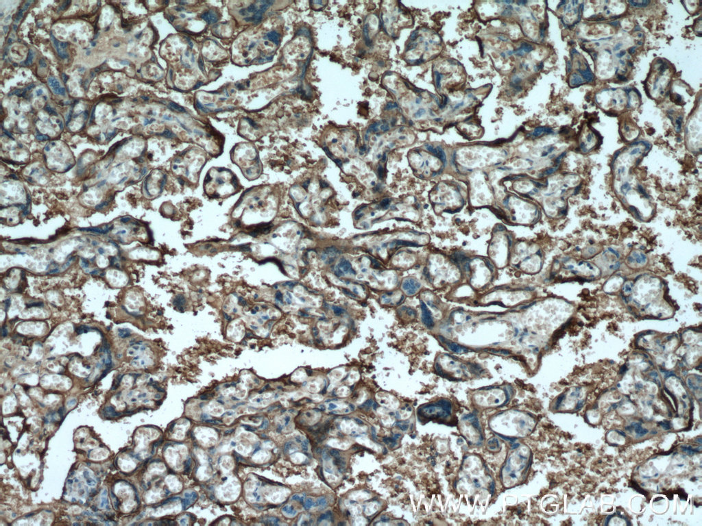 IHC staining of human placenta using 60294-1-Ig (same clone as 60294-1-PBS)