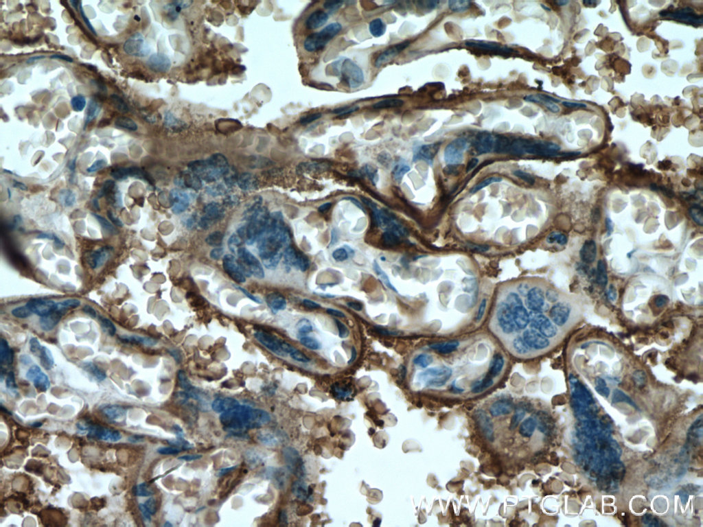 IHC staining of human placenta using 60294-1-Ig (same clone as 60294-1-PBS)