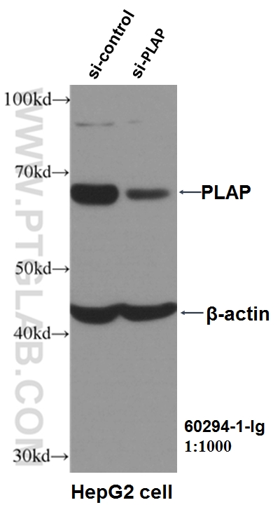 WB analysis of HepG2 using 60294-1-Ig (same clone as 60294-1-PBS)