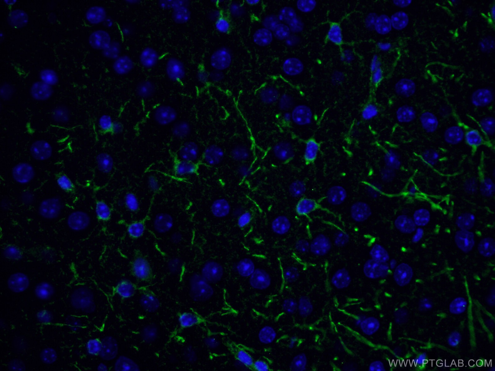 IF Staining of mouse brain using 10147-1-AP