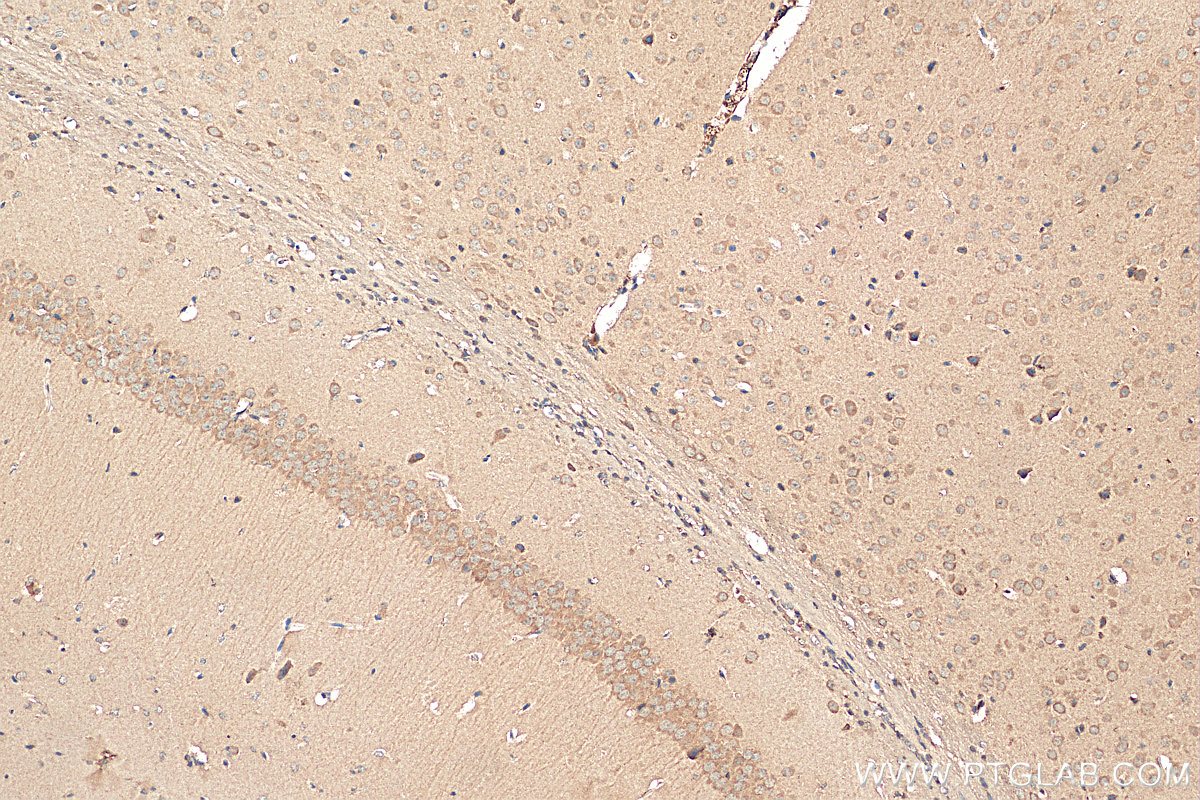 IHC staining of mouse brain using 10147-1-AP