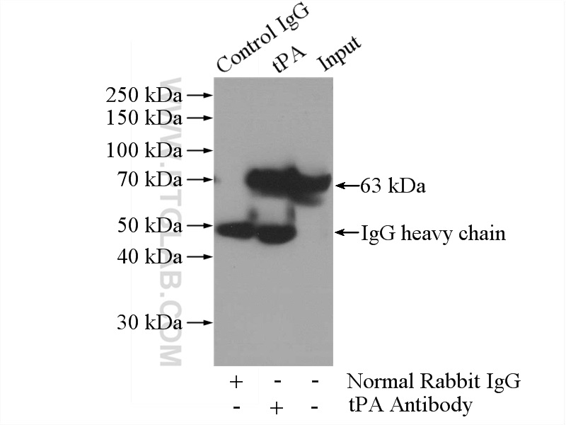 IP experiment of mouse kidney using 10147-1-AP