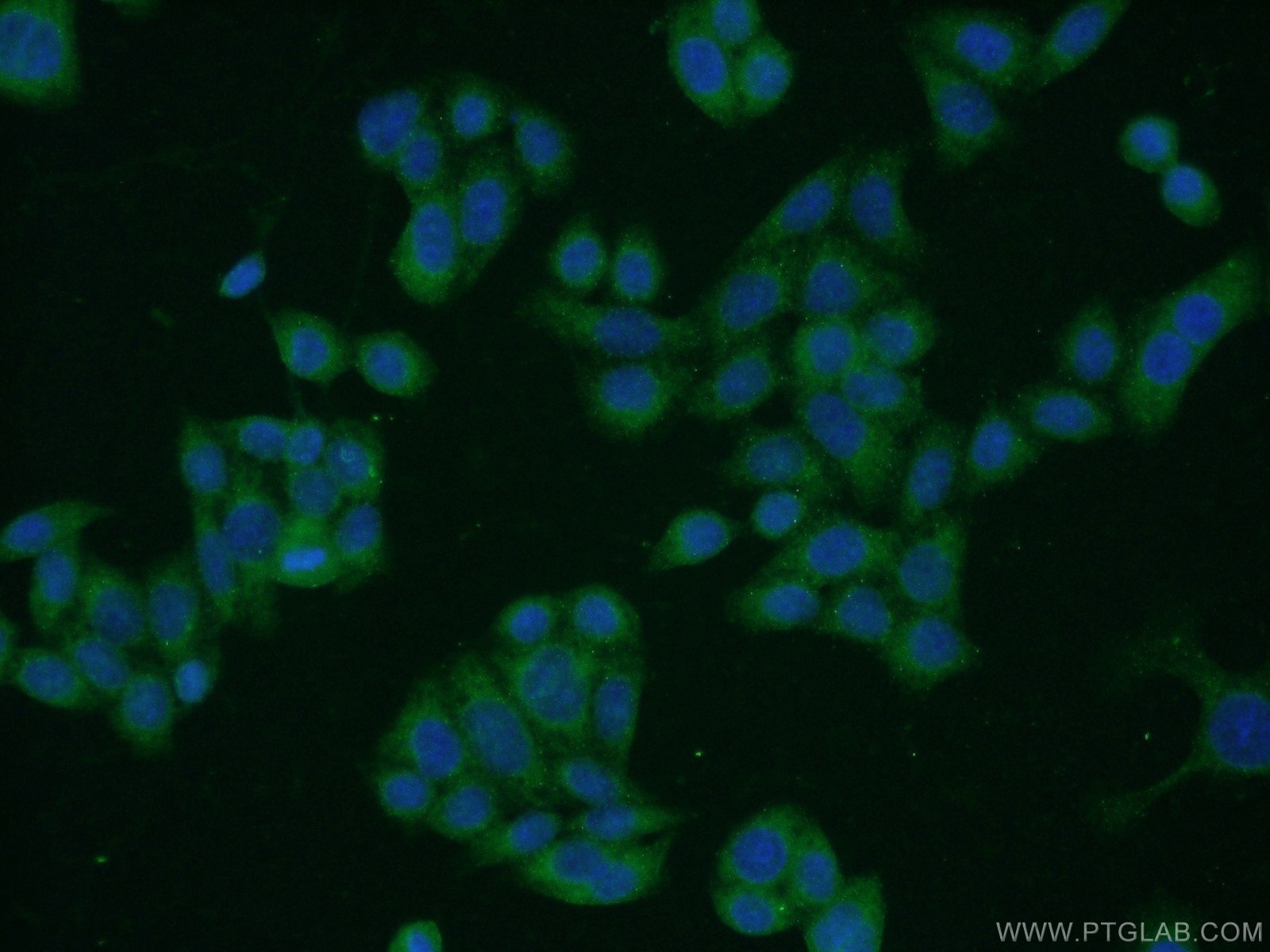 IF Staining of HeLa using 17968-1-AP