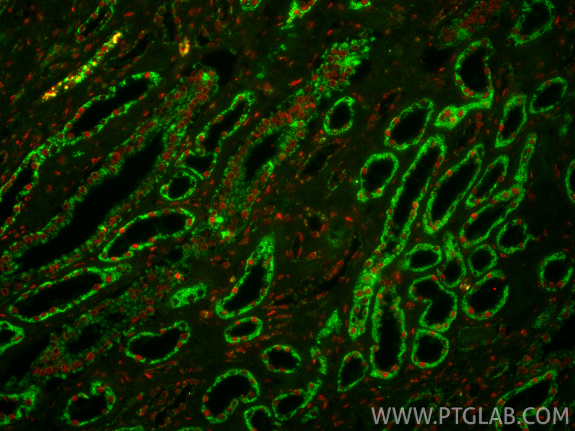IF Staining of human kidney using 17968-1-AP