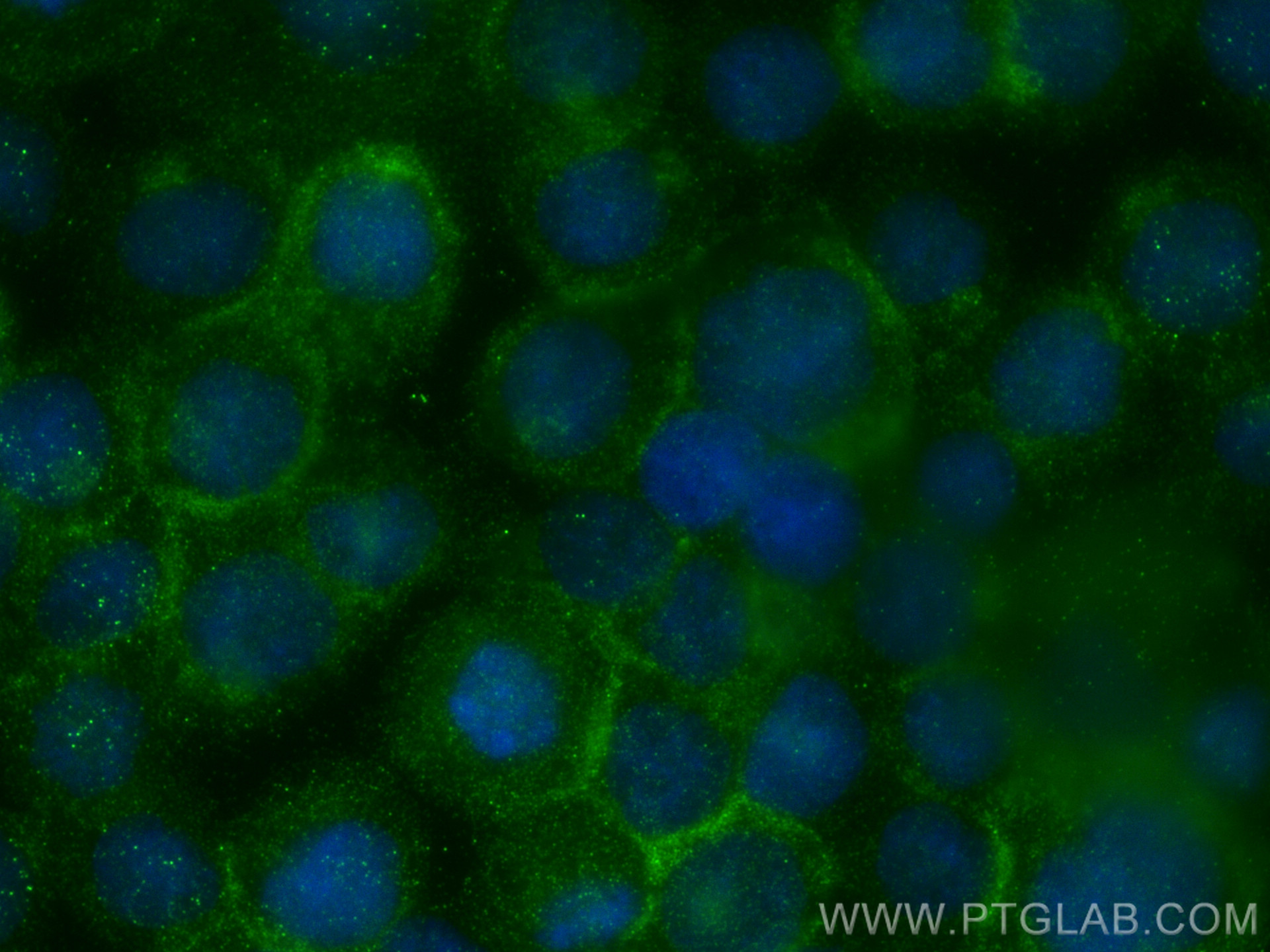 IF Staining of THP-1 using 27456-1-AP