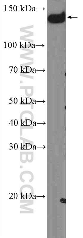 WB analysis of HeLa using 51139-1-AP