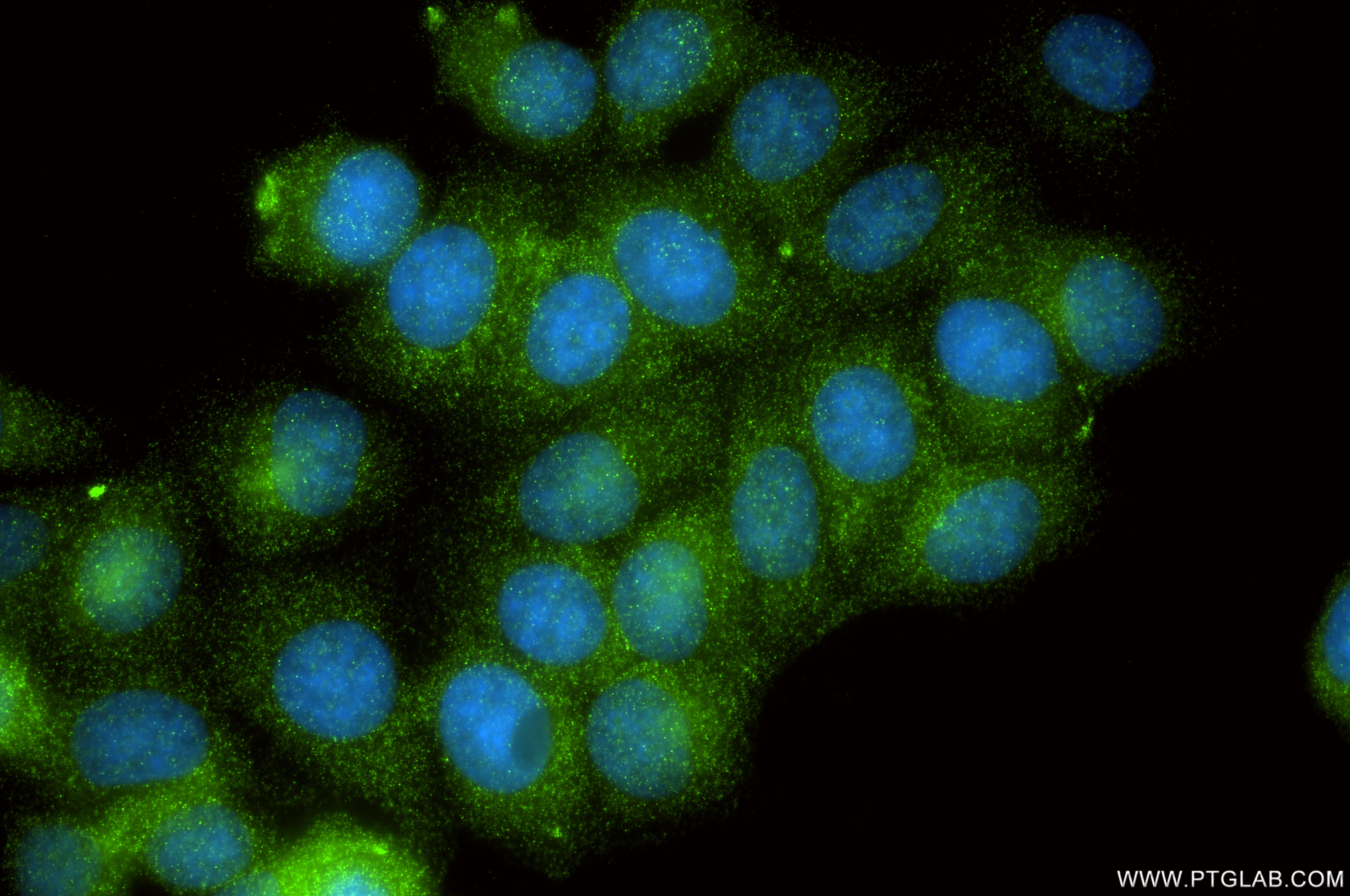IF Staining of MCF-7 using 85786-1-RR