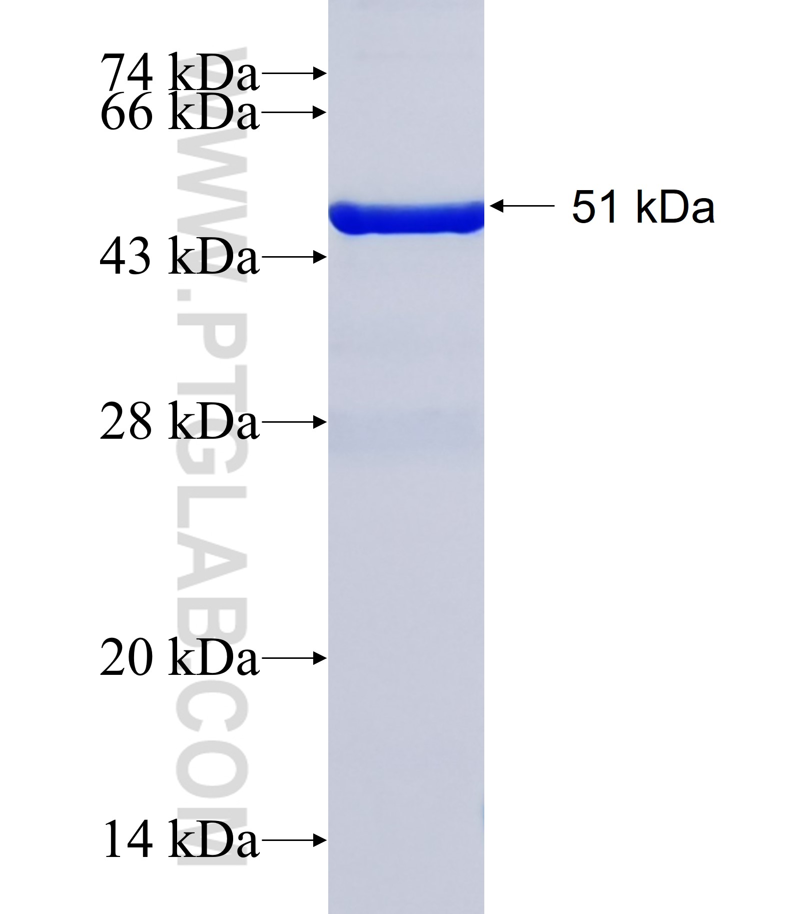PLCB4 fusion protein Ag38268 SDS-PAGE PLCB4 fusion protein Ag38268 SDS-PAGE