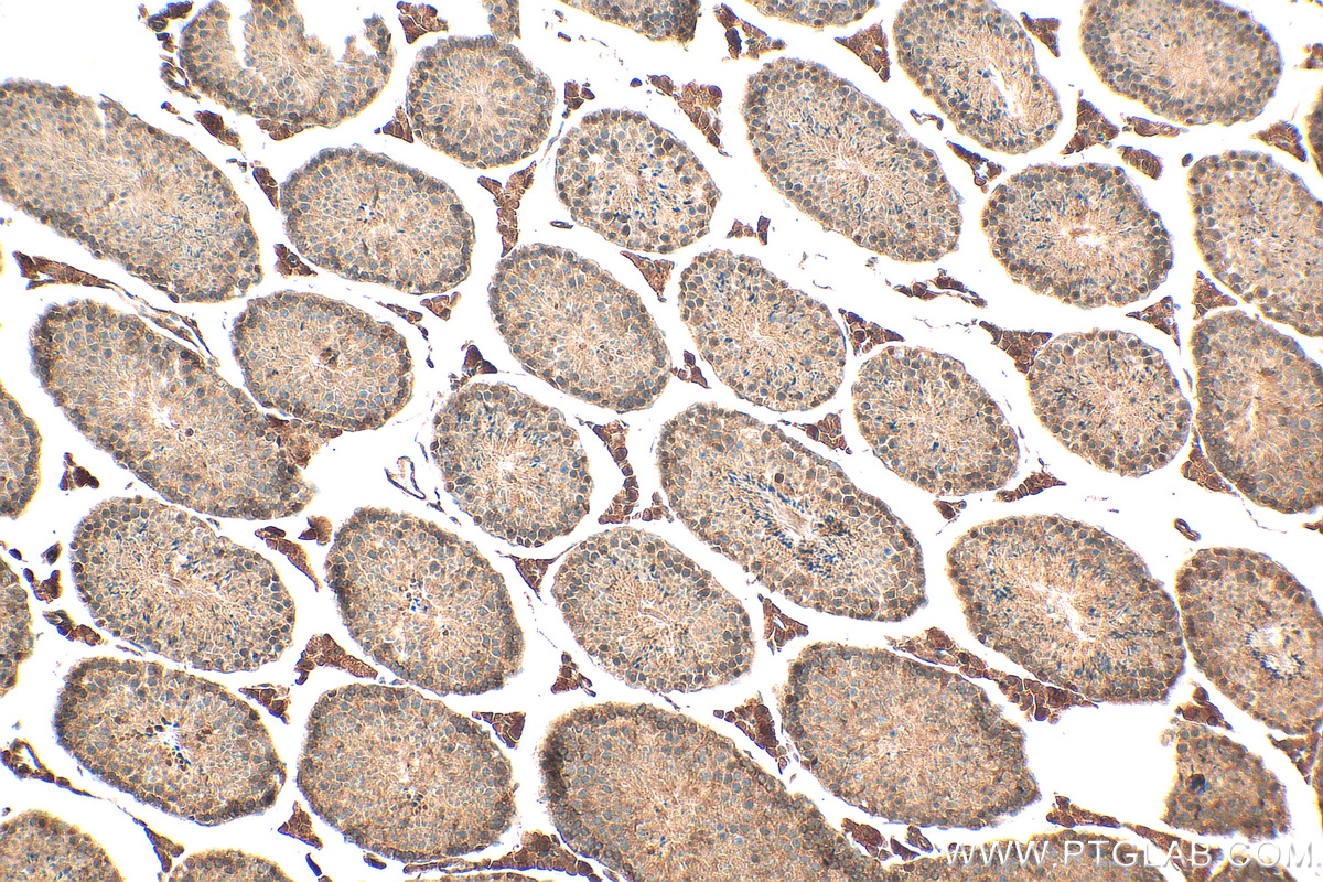 IHC staining of mouse testis using 30133-1-AP (same clone as 30133-1-PBS)