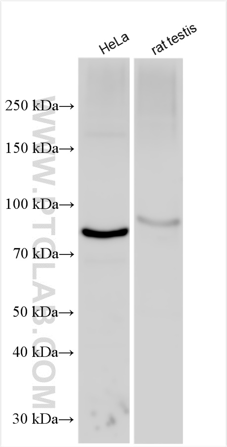 WB analysis of HeLa using 30133-1-AP (same clone as 30133-1-PBS)