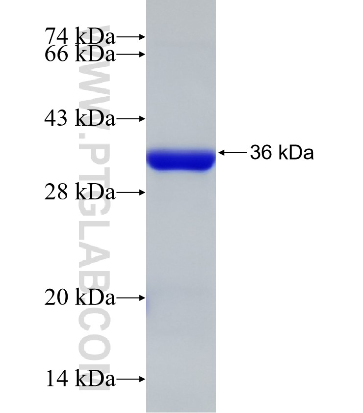 PLCD4 fusion protein Ag32676 SDS-PAGE PLCD4 fusion protein Ag32676 SDS-PAGE