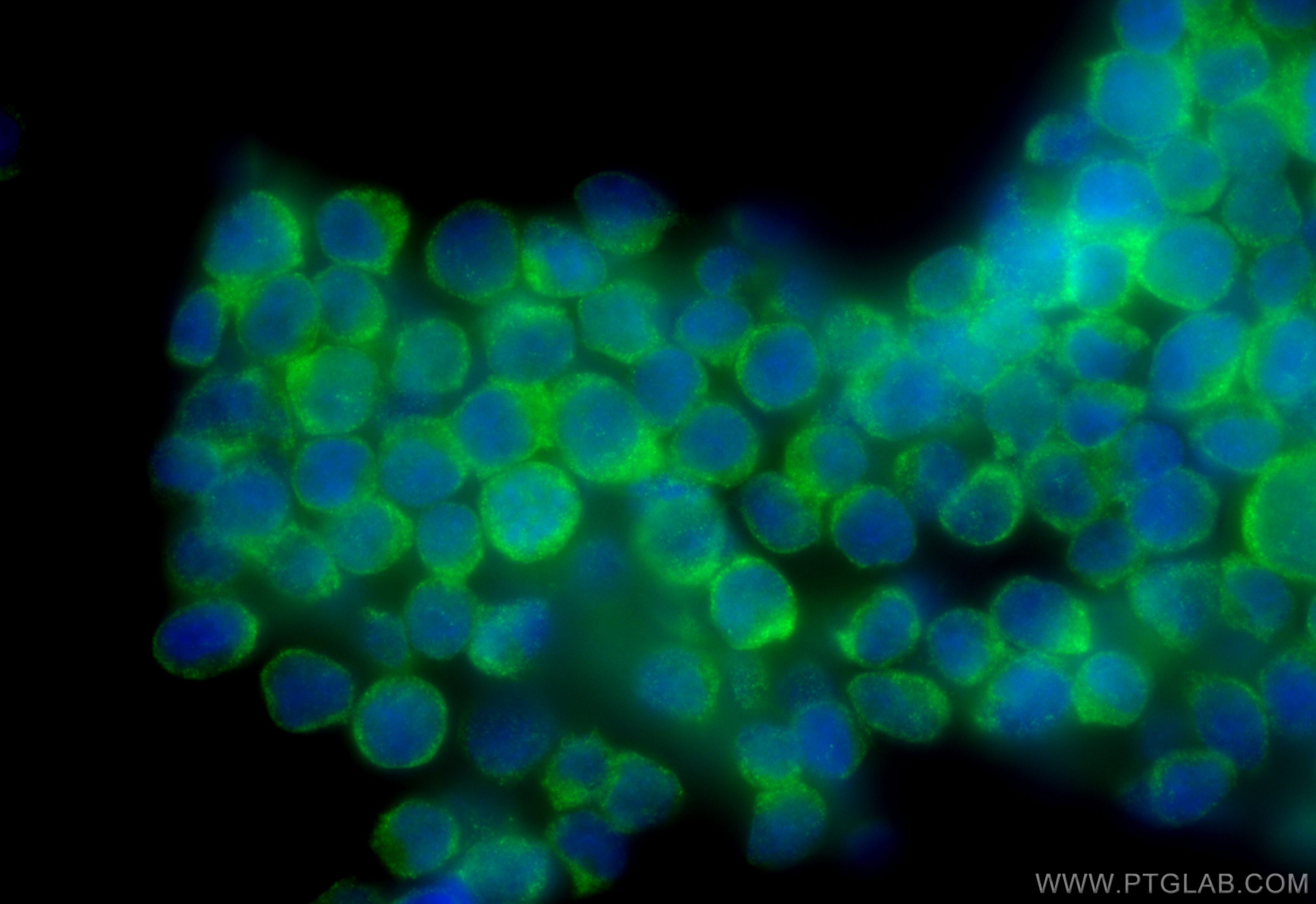 IF Staining of Jurkat using 28362-1-AP