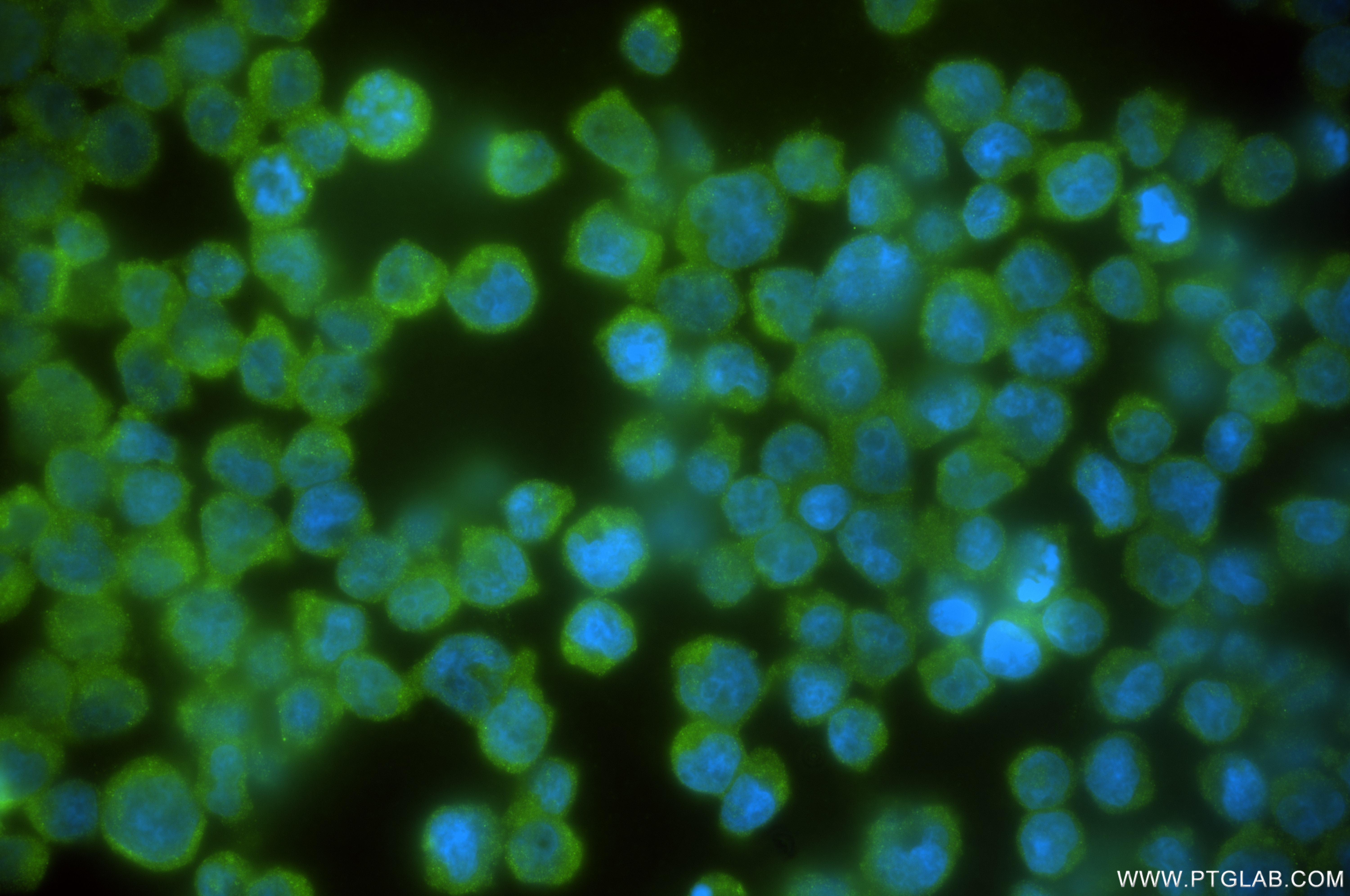 IF Staining of Jurkat using 84941-1-RR (same clone as 84941-1-PBS)
