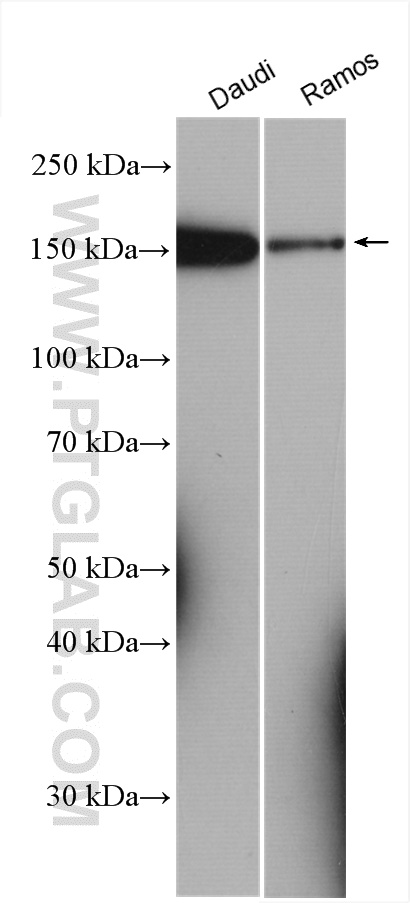 WB analysis using 29567-1-AP