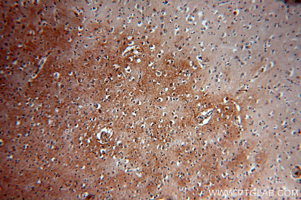 IHC staining of human brain using 19143-1-AP